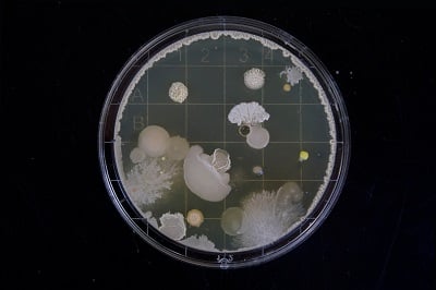 Photo credit to Michael Schiffer via Unsplash. Bacteria petri dish